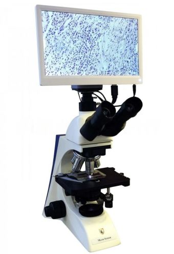 Микроскоп Micro Screen (ХОСПИТЕКС ДИАГНОСТИКС)